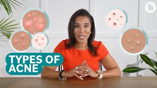 The Different Types of Acne and How to Treat Them [upl. by Acirretahs]