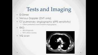 Pulmonary Embolism and DVT  USMLE Step 2 Review [upl. by Analim]