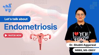 Endometriosis  Causes Symptoms amp Treatment [upl. by Khanna]