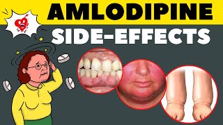 Amlodipine Side Effects amp How to Avoid  Amlodipine Adverse Effects [upl. by Asenev832]