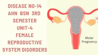 Hydatidiform MoleMolar pregnencyDisease14AHNBSN 3rdsemester Unit4female reproductive disorders [upl. by Airda183]