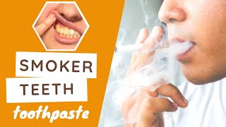 Best Toothpaste For Smokers  Remove Tough Teeth Stains Quickly [upl. by Norred156]