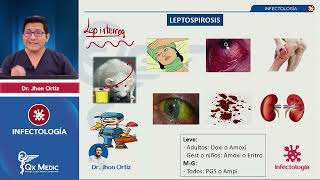 Infectología Banco histórico preguntas caso clínico ENAM QXMEDIC [upl. by Kevin]