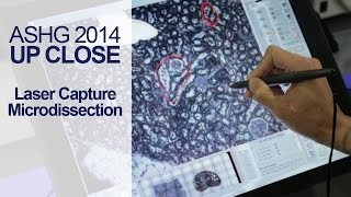 Introduction to Laser Capture Microdissection LCM  ASHG 2014 [upl. by Nnadroj378]