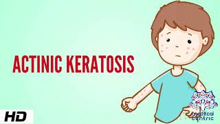 Actinic keratosis Causes Signs and Symptoms Diagnosis and Treatment [upl. by Haraj]