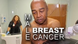 Men and Mammography  Early Detection of Male Breast Cancer [upl. by Bolitho]