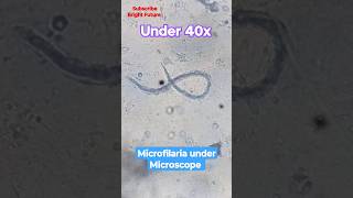 Microfilaria under microscope 🪱🪱 medical laboratory [upl. by Aititel]