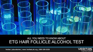 EtG Hair Follicle Alcohol Test All You Need to Know FAQ [upl. by Rezal]