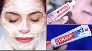 Colgate Face Mask Colgate toothpaste for face whiteningLemon  Colgate and Sugar [upl. by Shiau254]