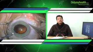 Common Age Related Eye Problems  Onlymyhealthcom [upl. by Sirrom547]