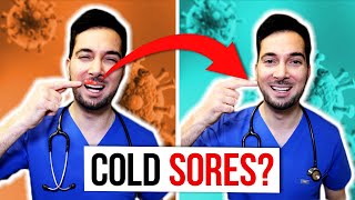 How to get rid of cold sores on lips fast and treatment [upl. by Bergeron658]