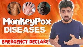 Monkeypox DiseasesEmergency DeclareAbhishek Rajan [upl. by Uela]