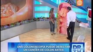 Cáncer de colon  Síntomas y tratamiento [upl. by Dnalra]