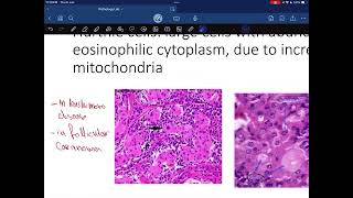 Pathology lab endocrine system [upl. by Odlavu]