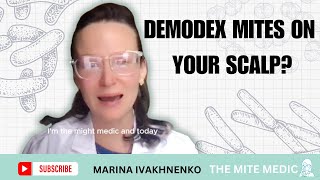 DEMODEX MITES ON MY SCALP TREATMENT SYMPTOMS ROOT CAUSES [upl. by Ennaj603]