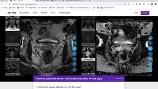 MRI PRO Prostate MRI Training Course  Tutorial [upl. by Oiluj980]