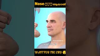 Nose cut ആയാൽWAIT FOR THE END 😯 [upl. by Laurin]