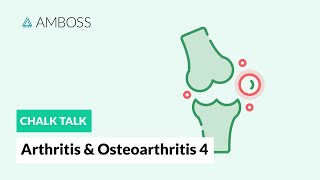 Arthritis amp Osteoarthritis  Part 4 Joint Involvement Patterns in Rheumatic Diseases [upl. by Zackariah]