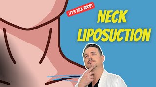 Double Chin Surgery  liposuction [upl. by Zoldi560]