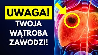 10 objawów że Twoja wątroba przestaje działać [upl. by Ayiotal]