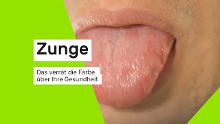 Das verrät die Zungenfarbe über Ihre Gesundheit [upl. by Yrrap766]