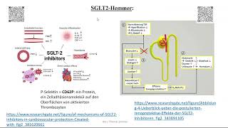 Herzinsuffizienz Therapie 6 SGLT2 Hemmer und Vericiguat [upl. by Reivilo619]