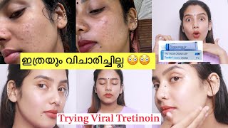 എന്നാലും നീ ആള് കൊള്ളാമല്ലോ 😳 1 Month Experience 😑Trying Viral Tretin cream 🧐 Clear Skin Rs 300 [upl. by Akimot]