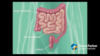 Colon v Rectal Cancer What you need to know [upl. by Ytsirc247]