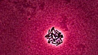 Lactobacillus  Time Lapse Photography [upl. by Teerell]