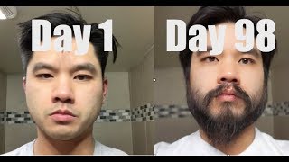 I Grew Out My Beard For 3 Months Using Minoxidil Rogaine [upl. by Suixela260]