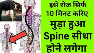 best stretches amp exercises for scoliosis S shape scoliosis exercises spine deformity physiotherapy [upl. by Hendrika171]