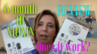 6 months of Nioxin review  hair treatment for fuller and thicker hair [upl. by Chiquita]