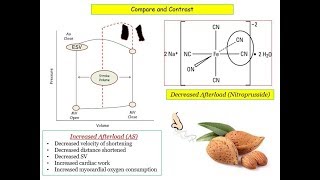 12DaysinMarch Valvular Heart Disease 7 Aortic Stenosis for the USMLE Step One Exam [upl. by Liddy]