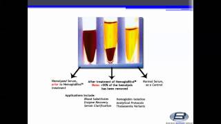 Biotech Support Group HemogloBind™ Hemoglobin Depletion From Hemolyzed SerumPlasma [upl. by Enovahs]