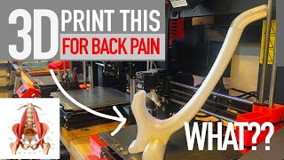 How 3D Printing removed my back pain [upl. by Ari964]