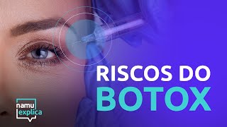 Riscos da aplicação de botox no rosto [upl. by Tybald67]