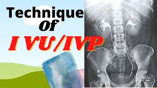 Technique of IVUIVP Ep36 Intravenous urogrampyelogram Procedure of IVUIVP test [upl. by Aikemat377]