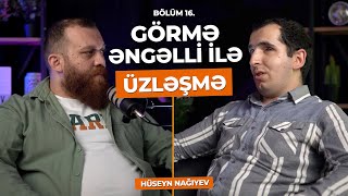 ÜZLƏŞMƏ GÖRMƏ ƏNGƏLLİ  16Bölüm  “BƏZƏN ELƏ BAXIRLAR Kİ SANKİ ADAM GÖRMƏYİBLƏR” [upl. by Anav]