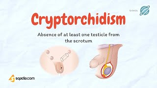 Cryptorchidism  Undescending Testicles  Causes Pathology  Pediatrics Video Lecture [upl. by Zita]