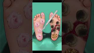 ASMR removing dog ticks amp worm from LegSeverely Injured shorts short asmranimationyoutubeshorts [upl. by Eceinahs160]