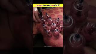 How Cupping Therepy Works 🤯 [upl. by Leilah945]