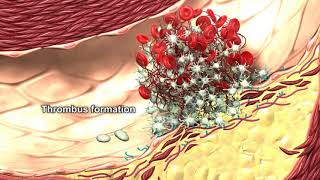 The Role of Autophagy in Thrombus Formation [upl. by Sherj]