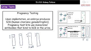 A Level Biology  5128  Kidney Failure [upl. by Nerissa]