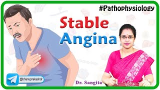 Stable Angina Causes Pathophysiology Symptoms Diagnosis and Treatment  Internal medicine [upl. by Sheridan855]