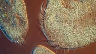 One Drop of Water Amazing High Definition Microscopy Video 1080P [upl. by Orvil]