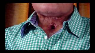 India  Tobacco Victims Advocacy Film Hindi [upl. by Lizzy40]