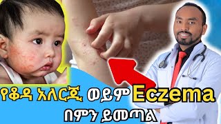 የቆዳ አለርጂ ወይም Eczema በምን ይመጣል  What causes skin allergy or eczema  Dr Fasil [upl. by Isleana]