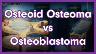 Osteoid Osteoma vs Osteoblastoma [upl. by Nuahsel]