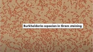 Burkholderia cepacia in Gram Staining of Culture Mag4000X [upl. by Noryak]