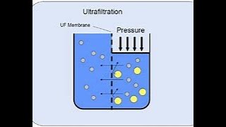 10 28 22 Ultrafiltration in hemodialysis patients [upl. by Timmy]